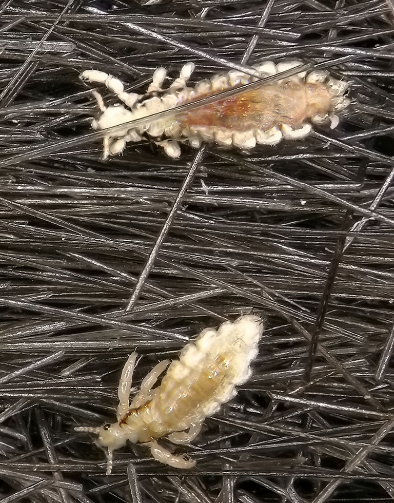 A closeup of lice.