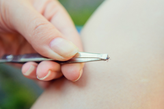 A tweezer with a tick in it.